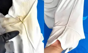 Antes y después de limpiar una camisa blanca amarillenta. La imagen de la izquierda muestra la mancha, la de la derecha, la prenda limpia.